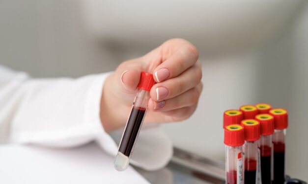 Esté atento a sus niveles de plaquetas en sangre